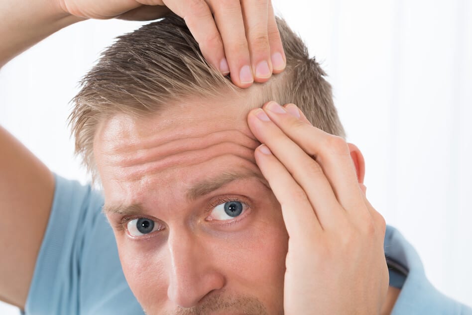 NeoGraft Hair Transplant with Dr. Rudy Coscia in Rosville, CA