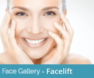 Facelift Recovery in Sacramento